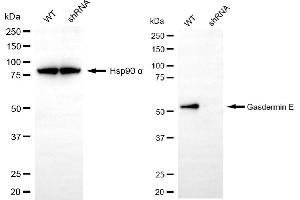 Western blotting analysis using gasdermin E antibody (ABIN7799622). (Recombinant Non-Syndromic Hearing Impairment Protein 5 (GSDME) anticorps)