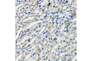 Immunohistochemistry of paraffin-embedded mouse kidney using COPB2 antibody. (COPB2 anticorps  (AA 657-906))