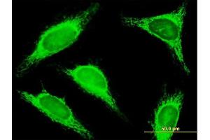 Immunofluorescence of purified MaxPab antibody to TRDD3 on HeLa cell. (TRDD3 anticorps  (AA 1-296))