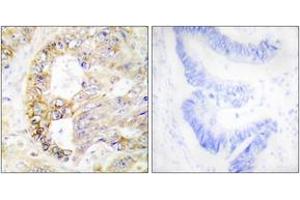 Immunohistochemistry analysis of paraffin-embedded human colon carcinoma tissue, using COX41 Antibody. (COX IV anticorps  (AA 11-60))