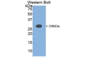 Western blot analysis of the recombinant protein. (CSNK1A1 anticorps  (AA 114-324))