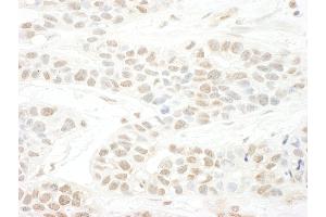 Immunohistochemistry (IHC) image for anti-BTB (POZ) Domain Containing 12 (BTBD12) (AA 1784-1834) antibody (ABIN7454441)