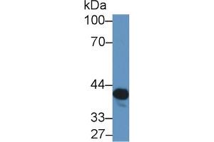 Detection of NAT2 in Rat Serum using Polyclonal Antibody to N-Acetyltransferase 2 (NAT2) (NAT2 anticorps  (AA 20-280))