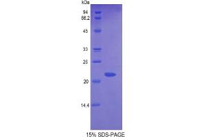 SDS-PAGE analysis of Mouse Glyoxalase I Protein. (GLO1 Protéine)