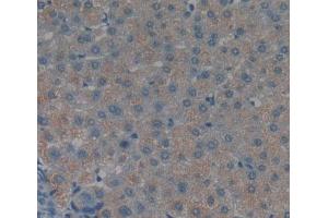 Used in DAB staining on fromalin fixed paraffin- embedded liver tissue (TNKS2 anticorps  (AA 959-1166))
