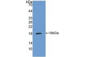 Detection of Recombinant IL5Ra, Human using Polyclonal Antibody to Interleukin 5 Receptor Alpha (IL5Ra) (IL5RA anticorps  (AA 42-182))