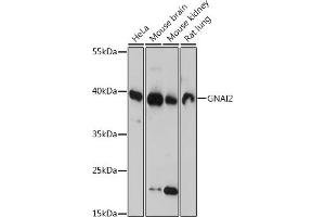Western blot analysis of extracts of various cell lines, using GN antibody (ABIN7267538) at 1:1000 dilution.
