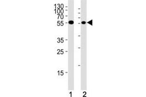 Chk1 antibody western blot analysis in (1) HeLa cell line and (2) mouse thymus tissue lysate (CHEK1 anticorps  (AA 258-287))