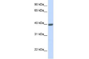 MAGEA1 antibody used at 1 ug/ml to detect target protein. (MAGEA1 anticorps)