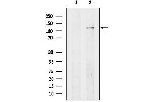 Western blot analysis of lysates from Hela cells, using ADCY4 Antibody.