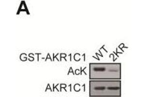 Acetylation has no effects on the reductase activity of AKR1C1.
