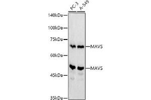 Western blot analysis of extracts of various cell lines, using MAVS antibody (ABIN6132297, ABIN6143583, ABIN6143584 and ABIN6221441) at 1:500 dilution. (MAVS anticorps  (AA 1-65))