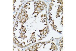 Immunohistochemistry of paraffin-embedded rat testis using GARS Rabbit pAb (ABIN6127942, ABIN6140964, ABIN6140966 and ABIN6221085) at dilution of 1:300 (40x lens).