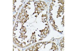Immunohistochemistry of paraffin-embedded rat testis using GARS Rabbit pAb (ABIN6127942, ABIN6140964, ABIN6140966 and ABIN6221085) at dilution of 1:300 (40x lens). (GARS anticorps  (AA 60-370))