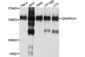 Western blot analysis of extract of various cells, using SMARCA1 antibody. (SMARCA1 anticorps)