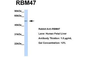 Host: Rabbit  Target Name: RBM47  Sample Tissue: Human Fetal Liver  Antibody Dilution: 1. (RBM47 anticorps  (Middle Region))