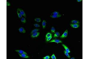 Immunofluorescent analysis of HepG2 cells using ABIN7155160 at dilution of 1:100 and Alexa Fluor 488-congugated AffiniPure Goat Anti-Rabbit IgG(H+L)