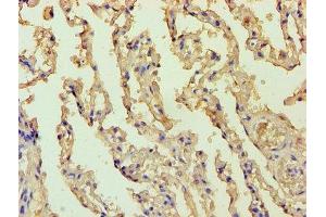 Immunohistochemistry of paraffin-embedded human lung tissue using ABIN7145166 at dilution of 1:100 (Cyclin D1 anticorps  (AA 1-233))