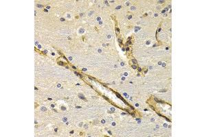 Immunohistochemistry of paraffin-embedded rat brain using KLKB1 antibody at dilution of 1:200 (400x lens). (KLKB1 anticorps)