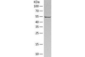 Western Blotting (WB) image for Ubiquitin Specific Peptidase 14 (USP14) (AA 1-494) protein (His-IF2DI Tag) (ABIN7125588)