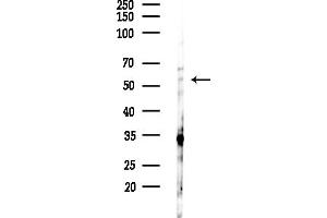 Western blot analysis of lysates from HepG2 cells(LPS,4h treatment), using C Antibody at 1/1000 dilution.