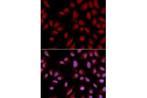 Immunofluorescence analysis of U2OS cells using DLGAP5 antibody. (DLGAP5 anticorps)