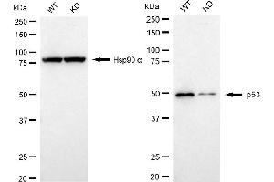 Western blotting analysis using p53 antibody (ABIN7800686). (Recombinant p53 anticorps)