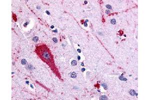Immunohistochemical (Formalin/PFA-fixed paraffin-embedded sections) staining in human brain (cortex) with HTR5A polyclonal antibody . (Serotonin Receptor 5A anticorps)