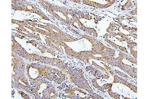 IHC analysis of TXN2 using anti-TXN2 antibody (ABIN7602150). (TXN2 anticorps  (AA 60-166))