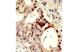 Image no. 1 for anti-DNA (Cytosine-5-)-Methyltransferase 3 Like (TRDMT1) (AA 388-417), (C-Term) antibody (ABIN356577)