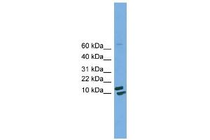 WB Suggested Anti-PPIH Antibody Titration: 0. (PPIH anticorps  (Middle Region))