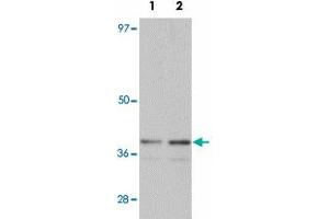 Western blot analysis of SLC39A1 in mouse kidney tissue lysate with SLC39A1 polyclonal antibody  at (1) 1 and (2) 2 ug/mL.