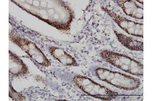 Immunoperoxidase of monoclonal antibody to WDR4 on formalin-fixed paraffin-embedded human small Intestine.