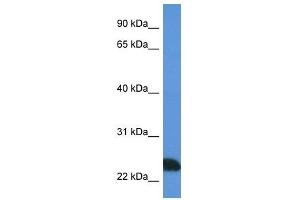 Western Blot showing PRSS1 antibody used at a concentration of 1 ug/ml against Jurkat Cell Lysate (PRSS1 anticorps  (N-Term))