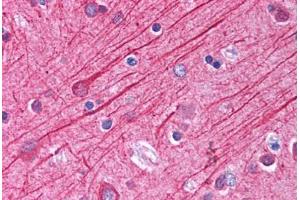 Human Brain, Cortex (formalin-fixed, paraffin-embedded) stained with Tubulin, Alpha 1 (TUBA1) antibody ABIN214603 at 2.