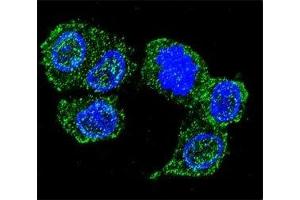 Confocal immunofluorescent analysis of JNK1 antibody with HepG2 cells followed by Alexa Fluor 488-conjugated goat anti-rabbit lgG (green).