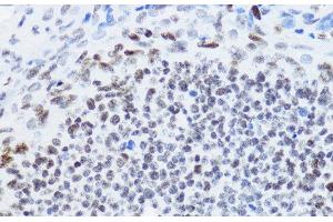 Immunohistochemistry of paraffin-embedded Rat ovary using Acetyl-Histone H4-K12 Polyclonal Antibody at dilution of 1:200 (40x lens).