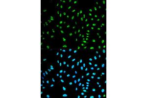 Immunofluorescence analysis of HeLa cell using NCF2 antibody. (NCF2 anticorps)