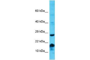 Host: Rabbit Target Name: MS4A6E Sample Type: Jurkat Whole Cell lysates Antibody Dilution: 1. (MS4A6E anticorps  (Middle Region))