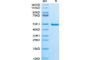 Human IDH1 on Tris-Bis PAGE under reduced condition.