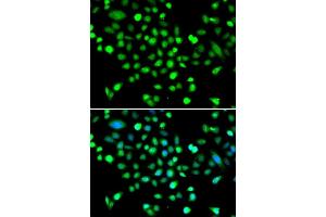 Immunofluorescence analysis of MCF-7 cells using PRK antibody (ABIN6132517, ABIN6146187, ABIN6146188 and ABIN6223135). (PRKAG1 anticorps  (AA 1-331))