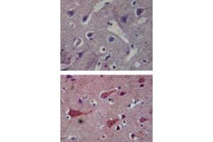 TLR8 Immunohistochemistry. (TLR8 anticorps)