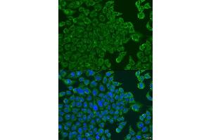 Immunofluorescence analysis of U2OS cells using ALOXE3 antibody.