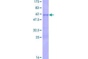 Image no. 1 for SNAIL (SNAI1) (AA 1-264) protein (GST tag) (ABIN1320738)