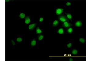 Immunofluorescence of monoclonal antibody to OXSR1 on HeLa cell. (OXSR1 anticorps  (AA 1-527))