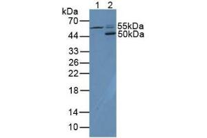 Western blot analysis of (1) Human HL-60 Cells and (2) Mouse Spleen Tissue. (CD4 anticorps  (AA 26-396))