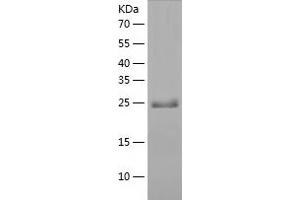 Western Blotting (WB) image for Sarcoglycan, beta (43kDa Dystrophin-Associated Glycoprotein) (SGCB) (AA 87-318) protein (His-IF2DI Tag) (ABIN7124984)