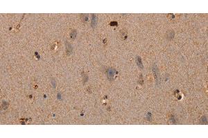Immunohistochemistry of paraffin-embedded Human brain tissue using PLXNA1 Polyclonal Antibody at dilution 1:30 (Plexin A1 anticorps)