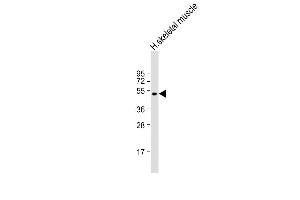 Anti-ZDHHC9 Antibody (C-term) at 1:2000 dilution + human skeletal muscle lysate Lysates/proteins at 20 μg per lane.