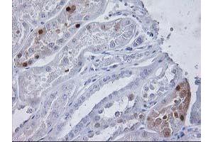 Immunohistochemical staining of paraffin-embedded Human Kidney tissue using anti-PGAM2 mouse monoclonal antibody. (PGAM2 anticorps)